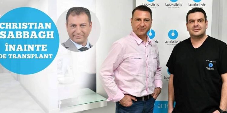 Implantul de par si importanta alegerii clinicii pentru aceasta procedura